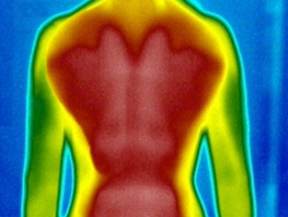 Infrarotkabine Thermoaufnahme Rücken